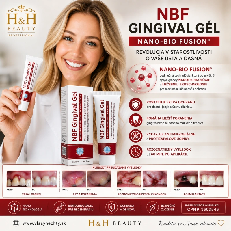 NBF GINGIVAL GÉL 1X30 g - na rany, popáleniny, herpes, zuby...
