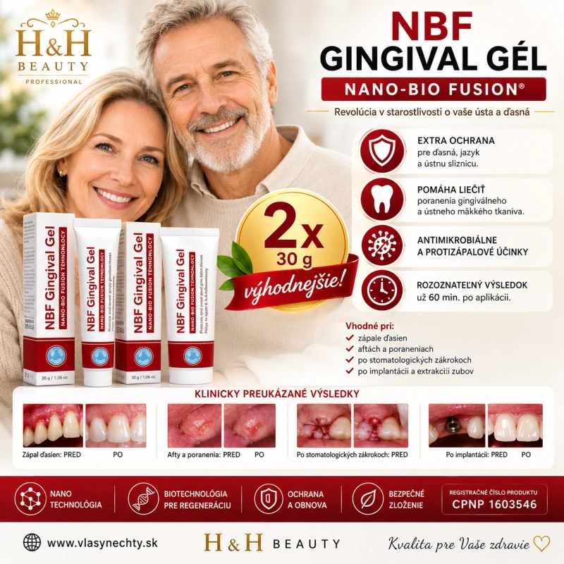 NBF GINGIVAL GÉL 2X30 g - na rany, popáleniny, herpes, zuby... 2 kusy